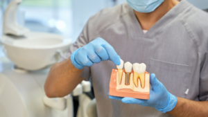 Dentist holding and demonstrating dental implants with gum disease